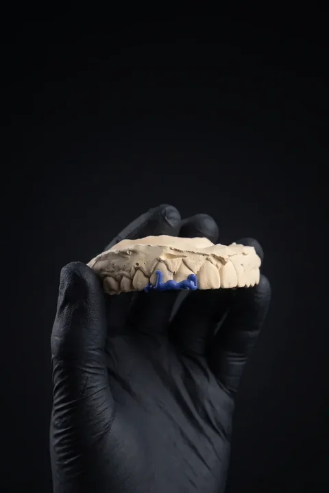 Mano con guante negro sosteniendo el molde con la pieza modelada en cera azul