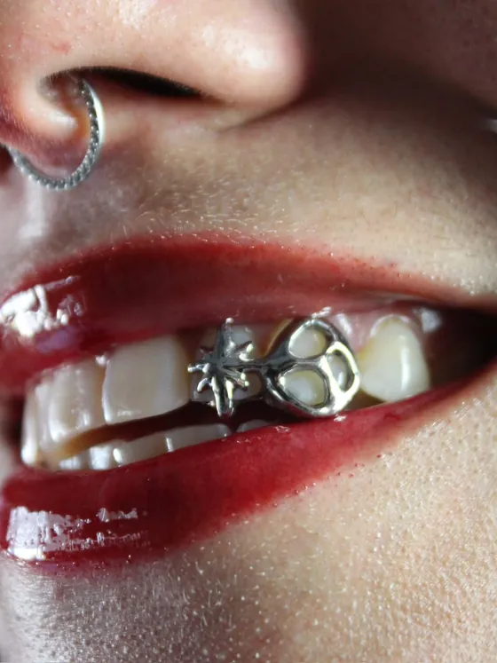 Boca sonriendo con una pieza de plata puesta sobre los dientes